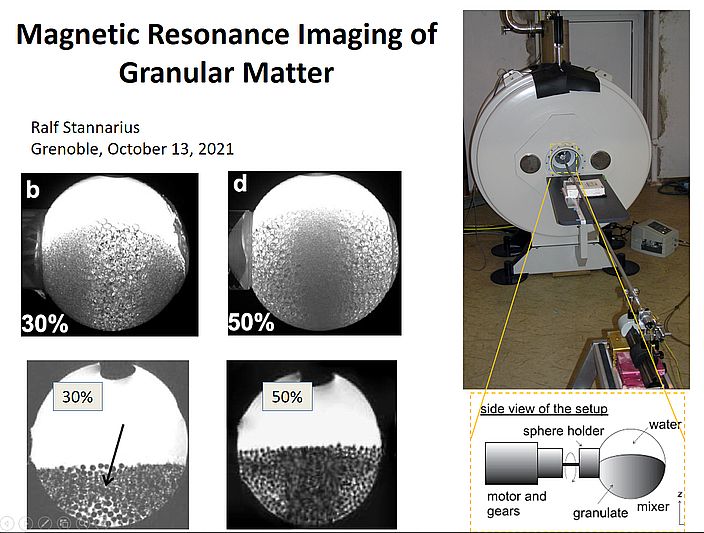 MRI-Grenoble